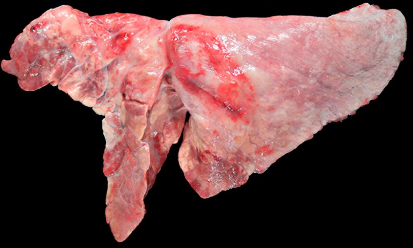 Фото 5: Коинфекция легких свиней&nbsp;M. hyopneumoniae и&nbsp;A. pleuropneumoniae. Красно-коричневые уплатннения в краниовентральной зоне, вызванные&nbsp;by&nbsp;M. hyopneumoniae, и овальные поражения с фиброзом плервы и кровоизлиянием в диафрагмальной доле, которые соответствуют хронической стадии после некроза, вызванного A. pleuropneumoniae.
